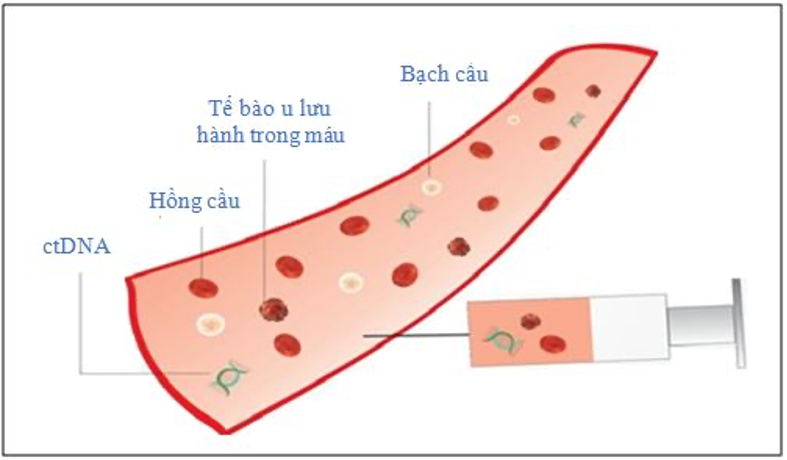 DNA của tế bào khối u lưu hành trong máu - dấu ấn sinh học trong dự đoán tái phát và tiên lượng ung thư đại trực tràng giai đoạn sớm